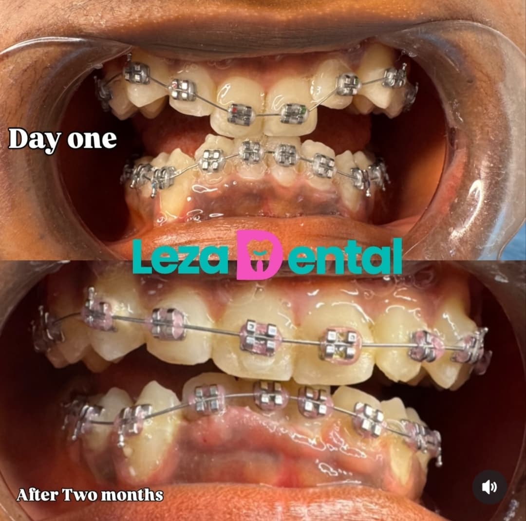 Before & After