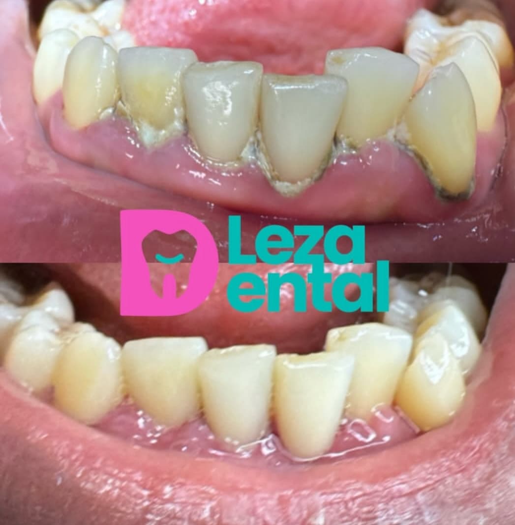 Before & After
