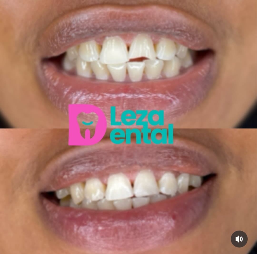 Before & After