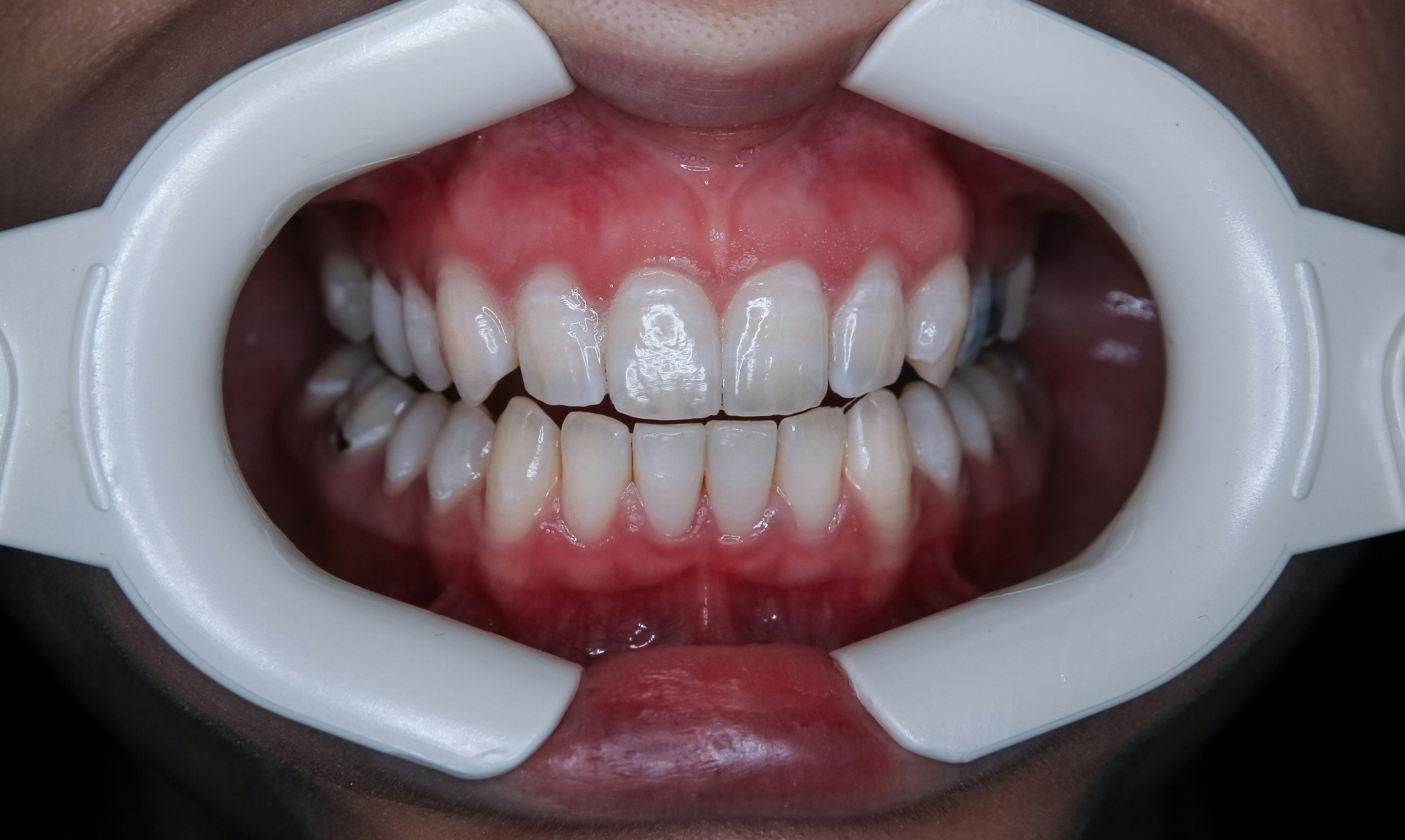 Leza Dental Clinic Enugu